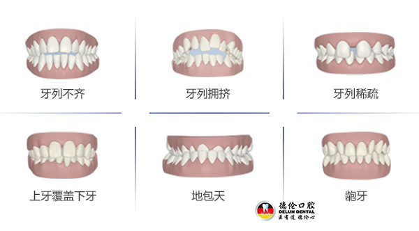 珠三角弓形脸居多 全国牙齿畸形高发