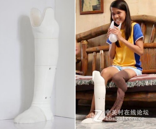 开发经济实用的3D打印假腿