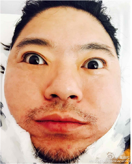 支招高晓松：让你的自拍不再是对网友的伤害