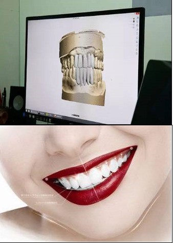 “瓷玉雕”是什么东西?为何广东电视台G4主持人热捧?