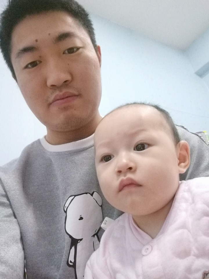 后置摄像头花黄