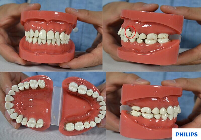 博朗电动牙刷好吗?爆款电动牙刷评测