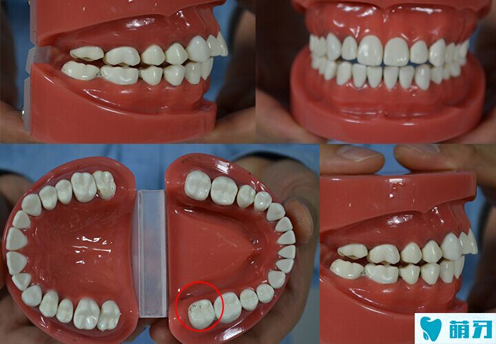 博朗电动牙刷好吗?爆款电动牙刷评测