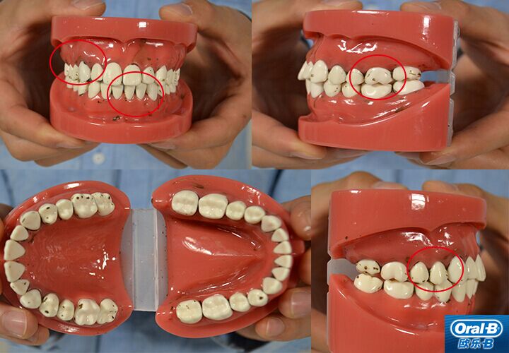 博朗电动牙刷好吗?爆款电动牙刷评测