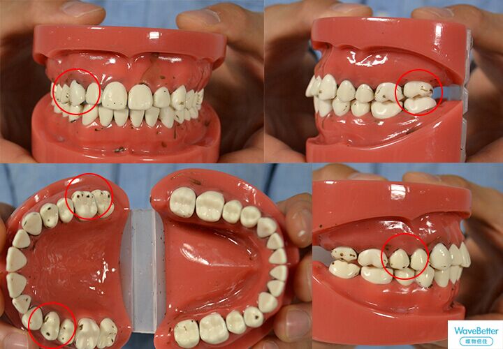 博朗电动牙刷好吗?爆款电动牙刷评测