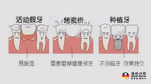牙齿缺失如何选择最佳的修复方式