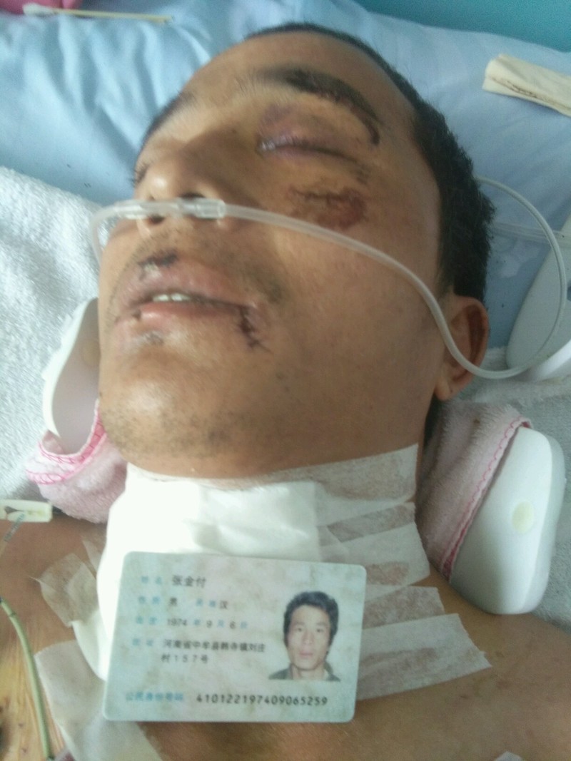 救人