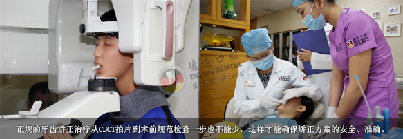 珠三角弓形脸居多 全国牙齿畸形高发