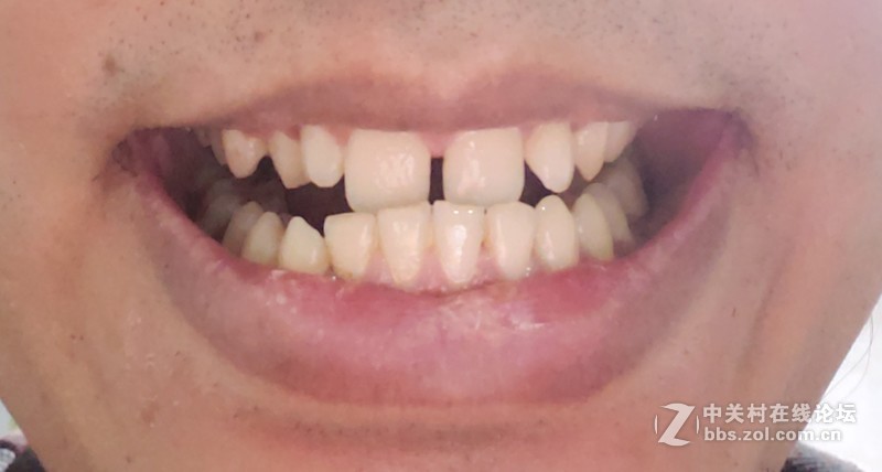 相见不恨晚，缺席才后悔——心诺冲牙器X628上手简评