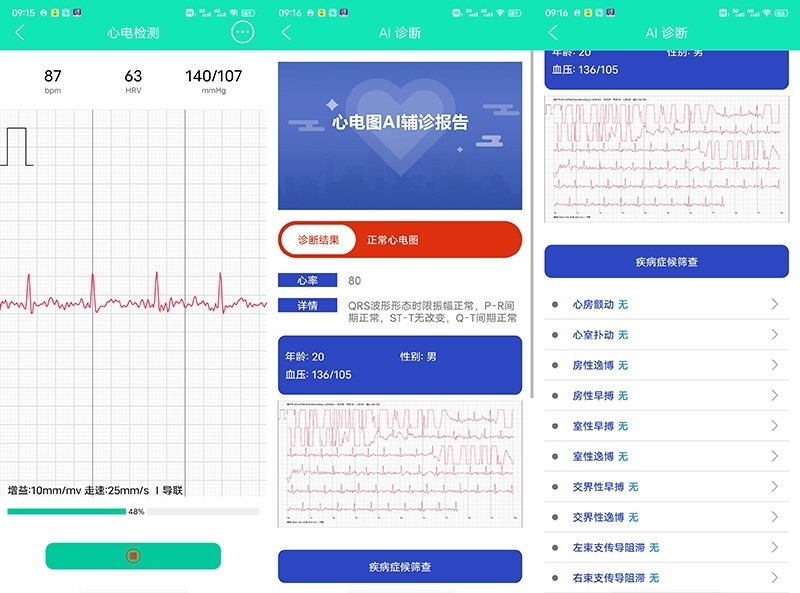 数据准、功能全才是硬道理——dido血压智能手表E10测评