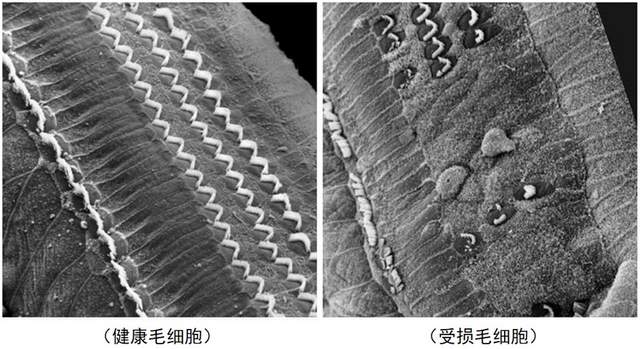 耳机多大声音伤听力？终于有解决办法了
