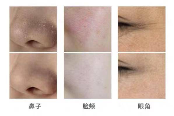 硬水和软水有什么区别？价格不菲的软水机究竟值不值得买？