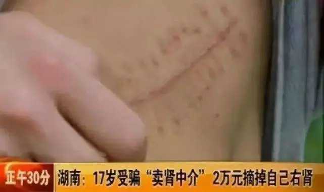 如何看待室友想买苹果手机，1年后换了二手安卓又说iPhone不好？