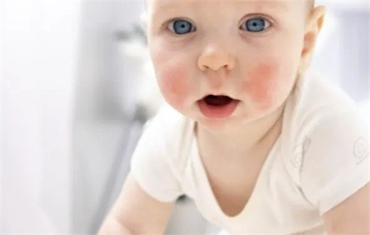 过敏因素有哪些？过敏了怎么办？预防和调理攻略来了！