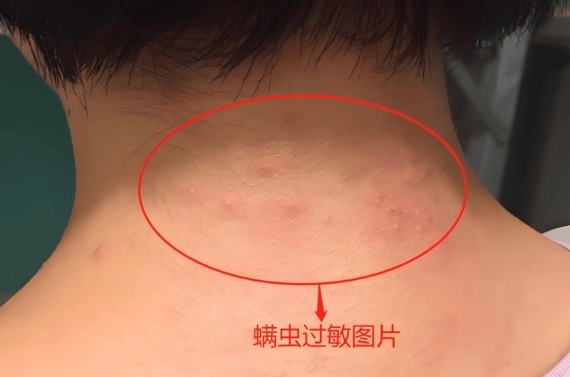 618狂欢节最建议买的除螨仪？2025年五款高口碑除螨仪机型推荐！