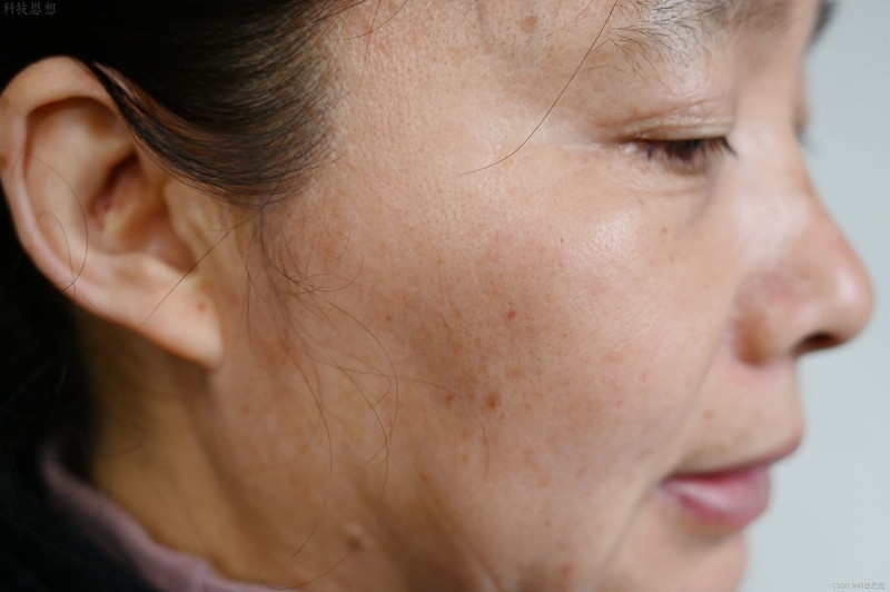 惊人的补水力！皮肤润到想掐的玻尿0酸面膜！