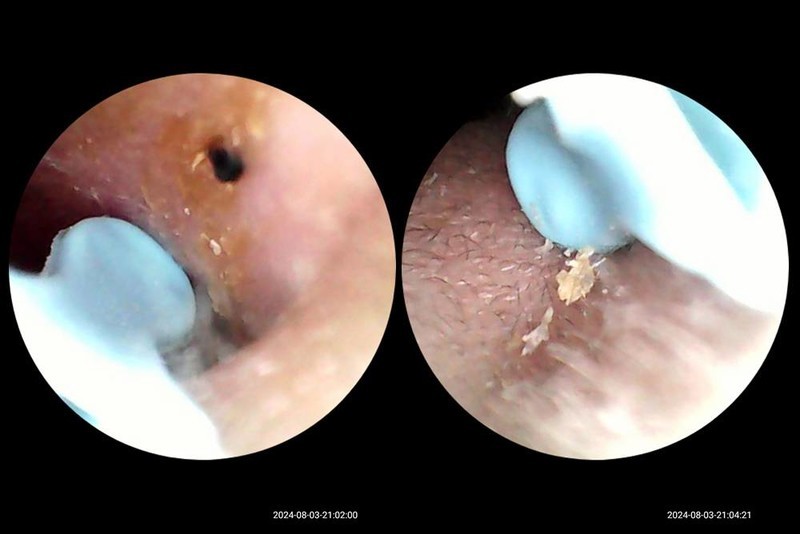 这才是清洁耳垢的正确方法，西圣Find智能可视掏耳勺评测