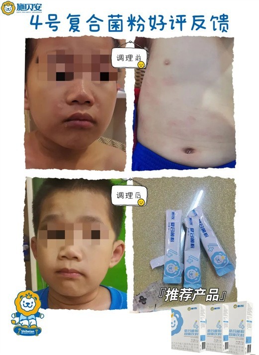“过敏”人群注意了！夏季也是高发期，专家推荐七大过敏防护建议