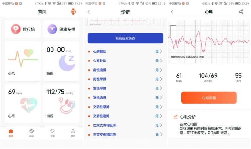 随时随地守护身体健康，dido E55S ProMax心电血糖智能手表