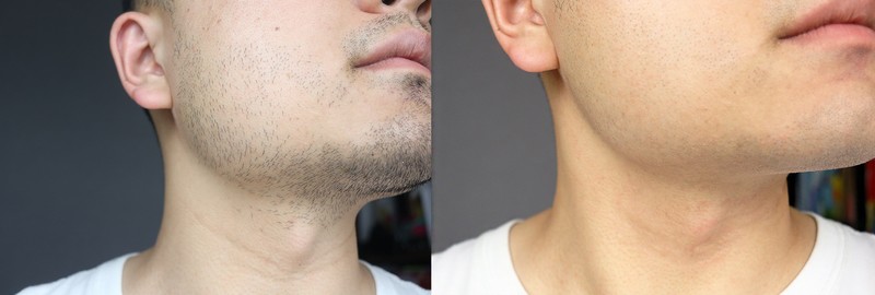 给你最丝滑的极限剃须体验——非常规的发烧性能未野剃须刀MAX