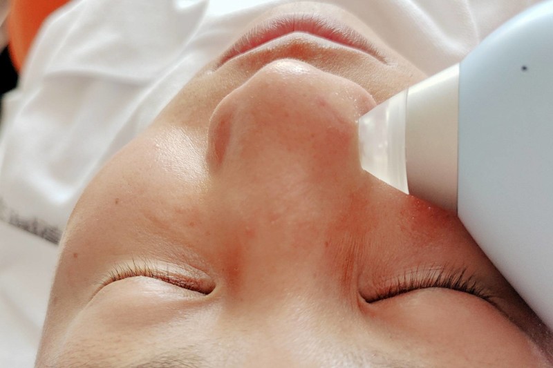 皮肤洁净小神器，DOCO冷热敷全能小气泡体验