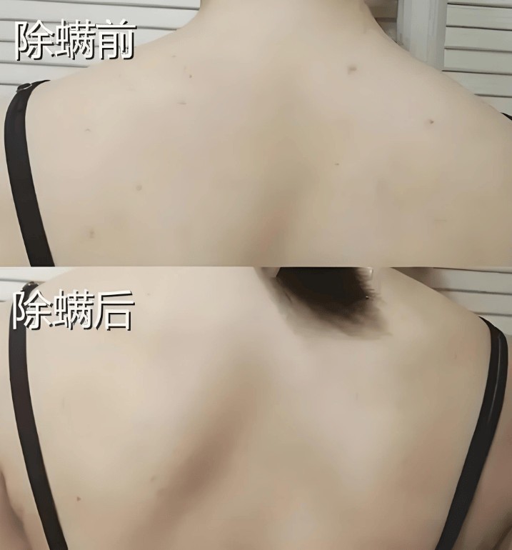 有线和无线除螨仪哪个效果好？除螨仪2025推荐：哪款除螨效果好？