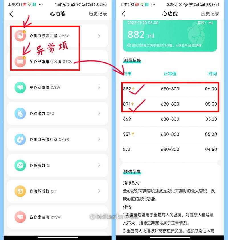 无需采血，腕上测血糖，亲测可以全天候体检的dido Y16S智能腕表