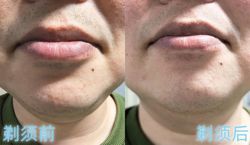 一万三超高转速配德国进口0.06mm刀片硬件拉满，未野MAX全面起飞