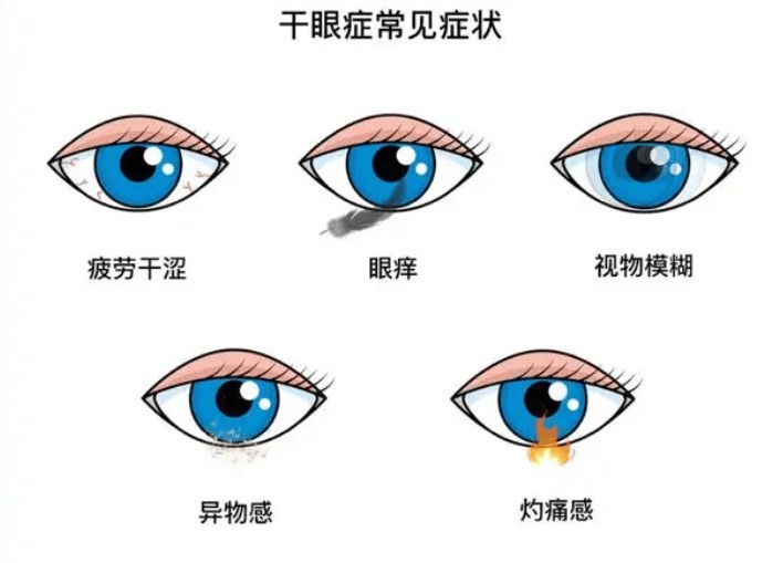 屏幕挂灯是不是智商税？屏幕挂灯的行业乱象揭秘