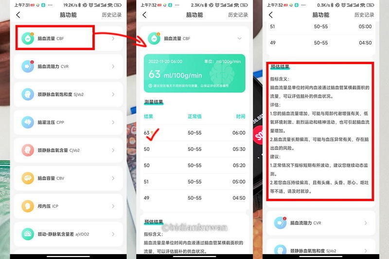 无需采血，腕上测血糖，亲测可以全天候体检的dido Y16S智能腕表