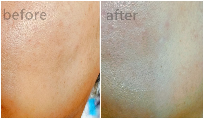 七夕礼物清单： 尤加西元气弹美容仪，保持年轻美丽的“精明”之选