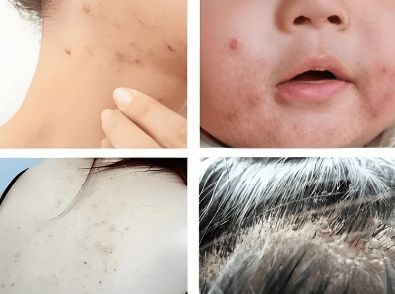 除螨仪怎么选最好？2025年可闭眼入的5款高性价比除螨仪推荐！