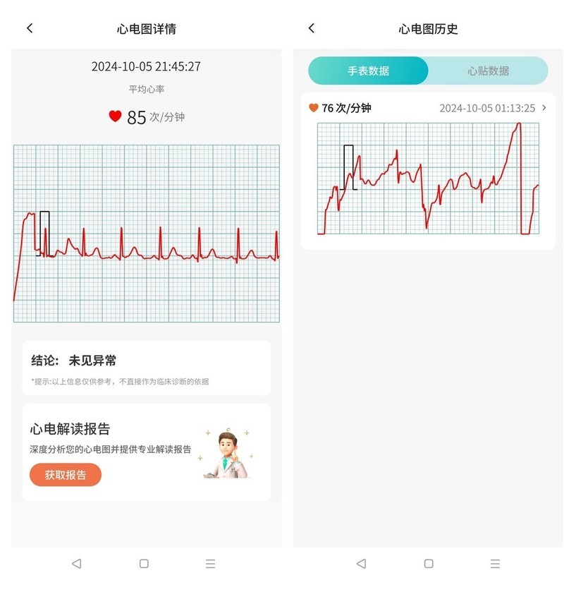 腕上健康顾问，也是生活助手，圆道妙医心电手表