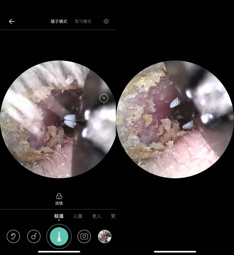 告别耳屎！采耳神器Note3 Pro Max体验，真的会上瘾