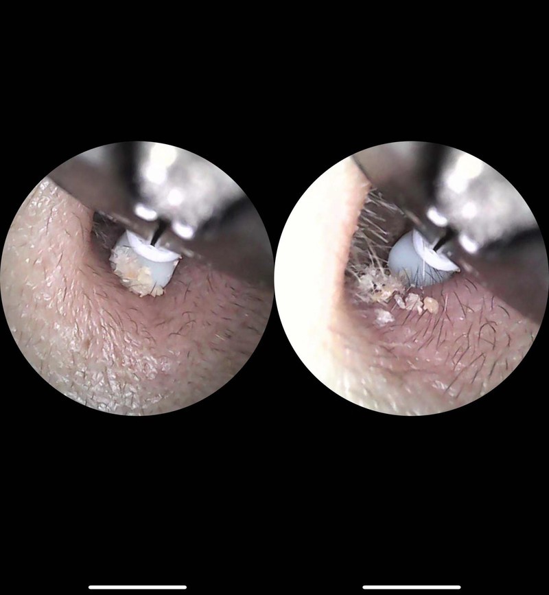 告别耳屎！采耳神器Note3 Pro Max体验，真的会上瘾