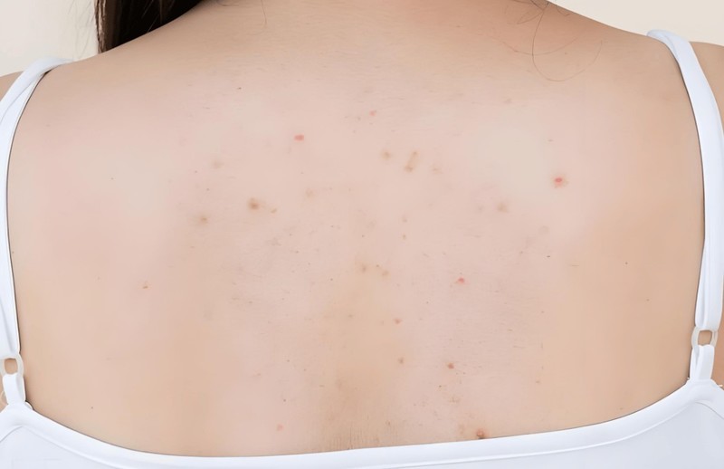 除螨仪排行榜前十有哪些？2025 年热门除螨仪推荐榜单！必看系列！