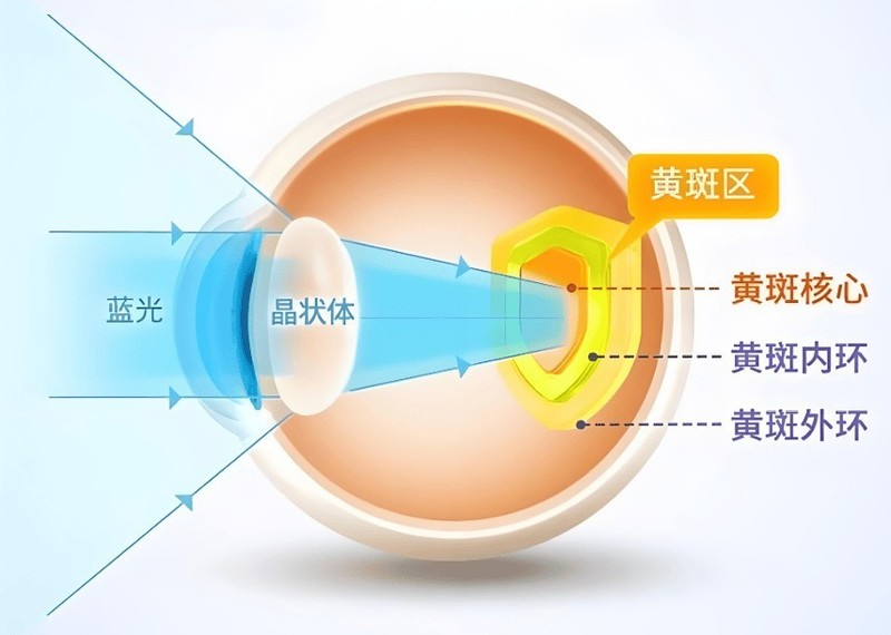 号称预防近视护眼灯是不是骗人的？劣质台灯毁眼不只是传言