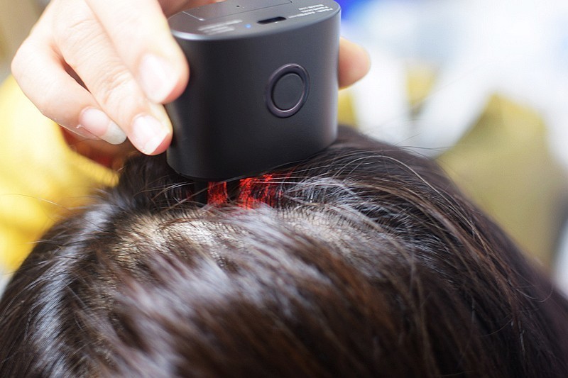 打造健康秀发的智能护发新选择 DOCO头皮护理仪mini
