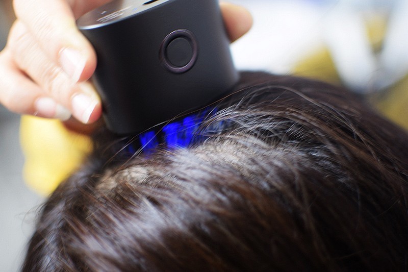 打造健康秀发的智能护发新选择 DOCO头皮护理仪mini