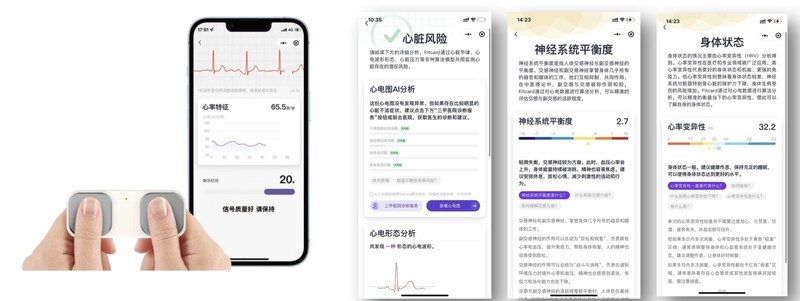 全国产化手持单导心电仪技术解决方案，助力血压计厂商实现房颤精准捕捉