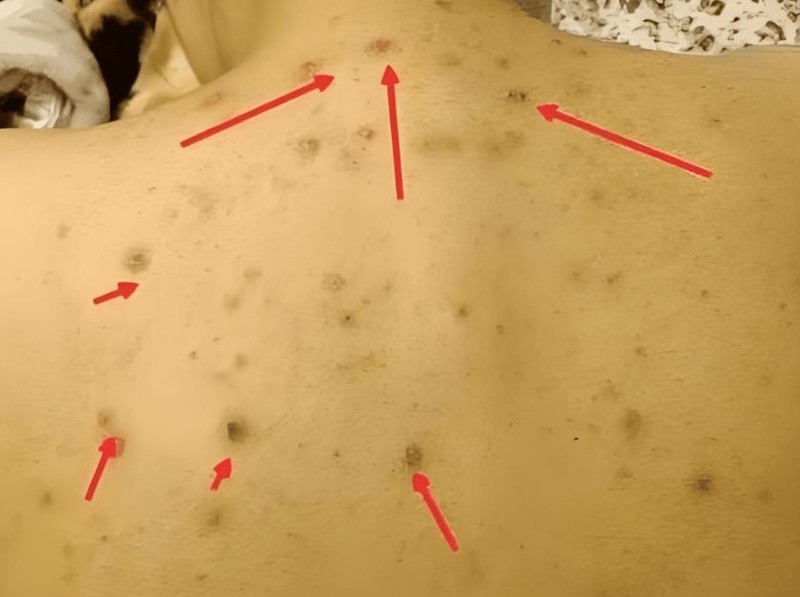 618 必看！除 螨 仪家用哪个好？五大口碑爆款机型真实测评与推荐！