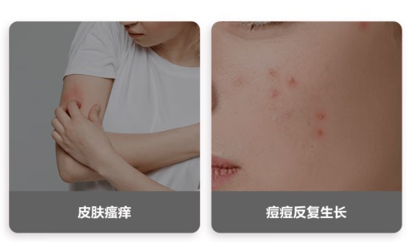 家用除螨仪是否真有用？2025年这5款除螨仪强烈推荐！必看！