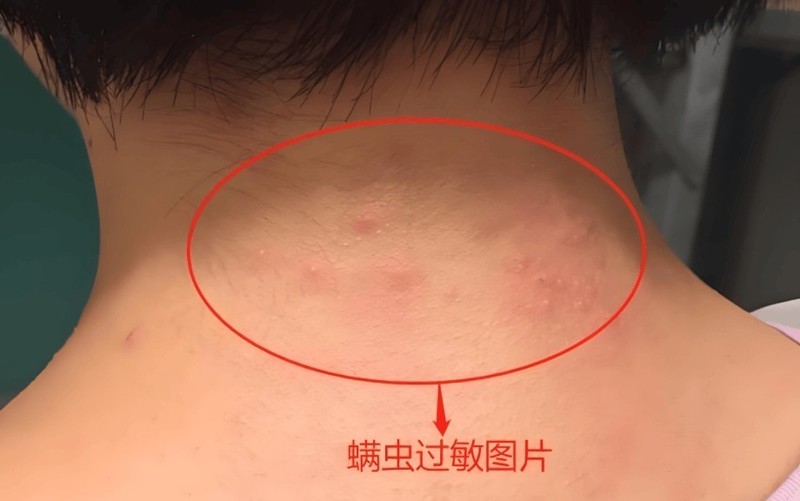 床上用品除螨仪到底有木有用？盘点五大硬核除螨仪机型！