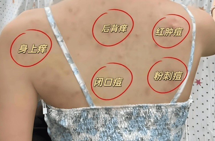 床上用品除螨仪到底有木有用？盘点五大硬核除螨仪机型！