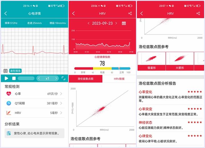 didoF50 SPro健康智能手环怎么样？监测血糖到底准不准