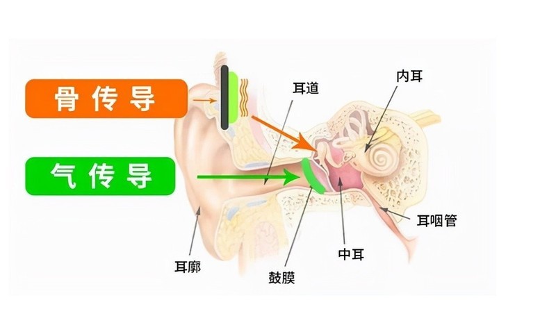 骨传导耳机怎么选？小白必看的五大选购技巧