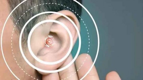 性价比高的开放式耳机有哪些推荐？性价比高的开放式耳机前十排名