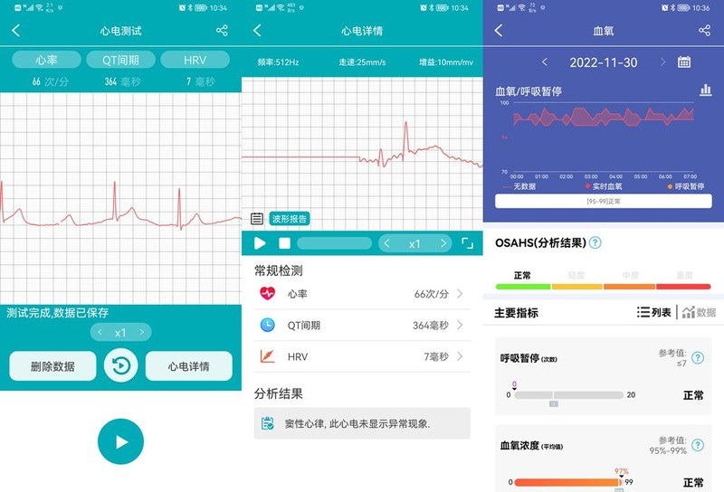 24小时监测、DIY表盘，dido E55S无创血糖监测智能手表体验