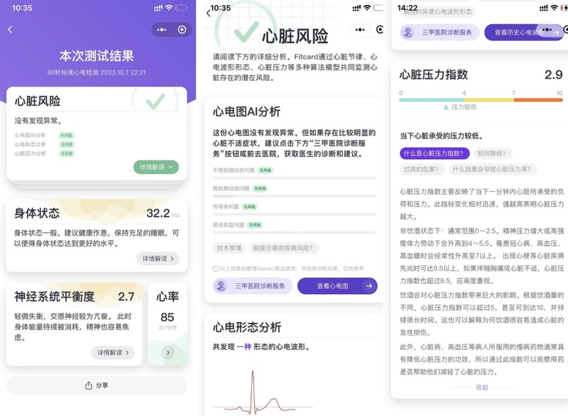 联通智家迎来唯理家用心电仪FitCard，助力用户居家心脏健康管理