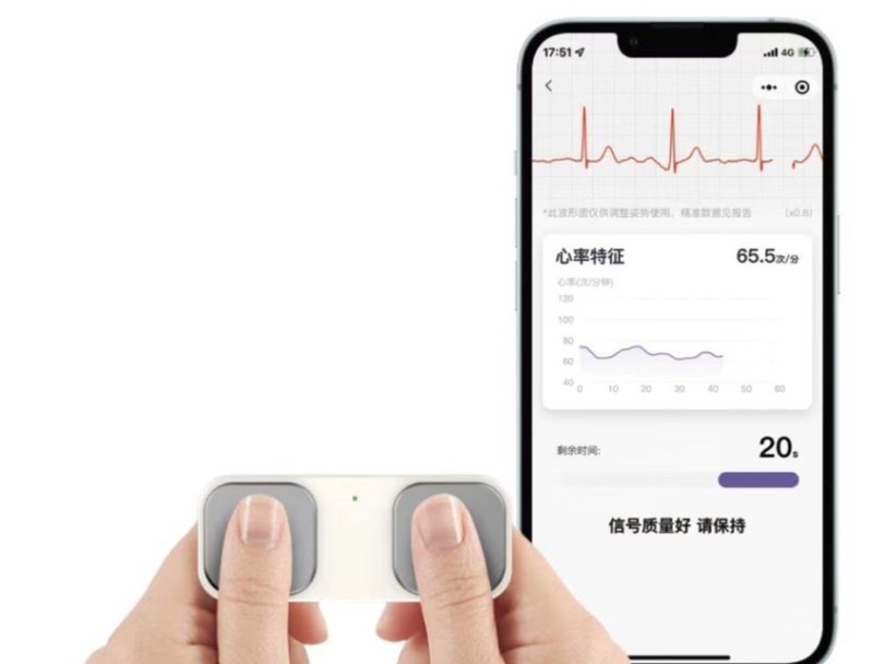 联通智家迎来唯理家用心电仪FitCard，助力用户居家心脏健康管理
